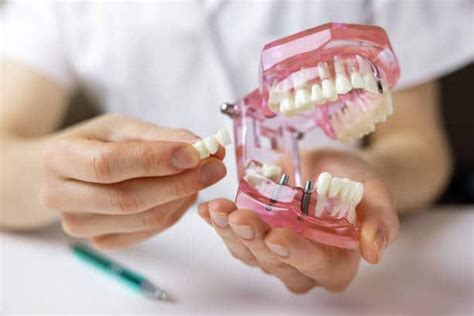 ارخص زراعة اسنان في الرياض